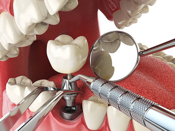 Best Emergency Dental Surgery in Conning Towers Nautilus Park, CT